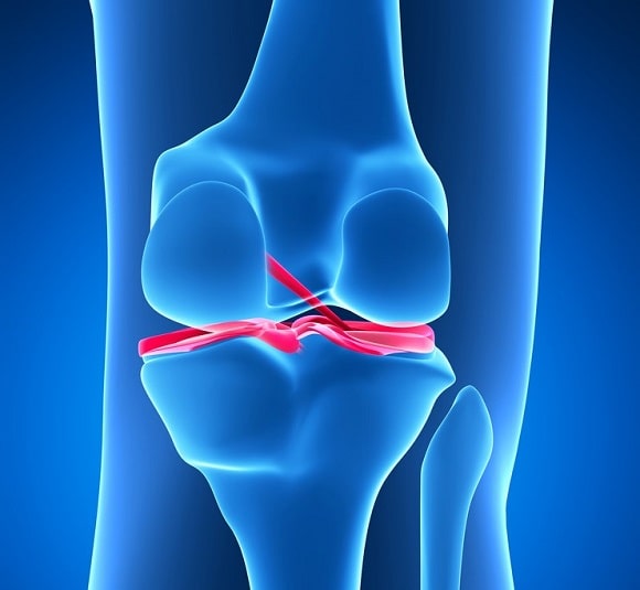 meniscus-klachten-knie-informatie